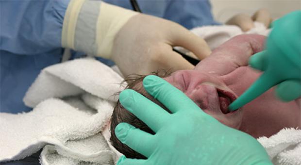 طموح العقي عند الأطفال حديثي الولادة